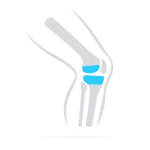 6 mesečni rehabilitacijski program vaj po operaciji, zamenjavi kolena